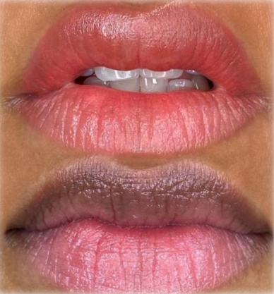 NEUTRALIZACION LABIAL